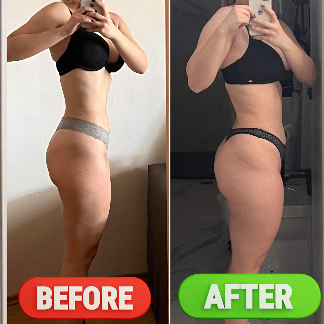 Remodelare corporală
